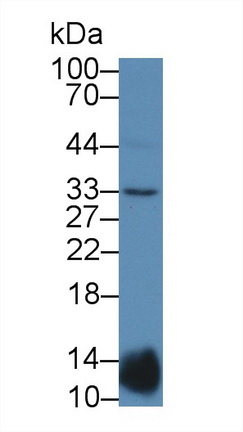 Polyclonal Antibody to Insulin Like Growth Factor Binding Protein 2 (IGFBP2)