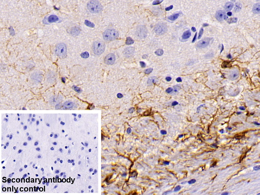 Polyclonal Antibody to Insulin Like Growth Factor Binding Protein 2 (IGFBP2)