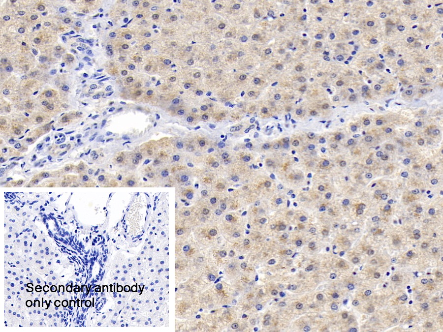 Polyclonal Antibody to Insulin Like Growth Factor Binding Protein 2 (IGFBP2)