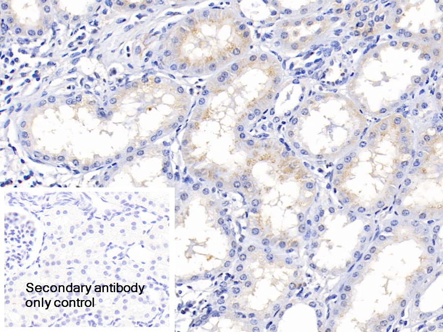 Polyclonal Antibody to Insulin Like Growth Factor Binding Protein 2 (IGFBP2)