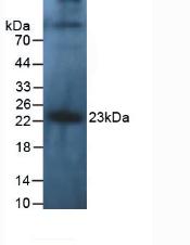 Polyclonal Antibody to Interleukin 10 (IL10)