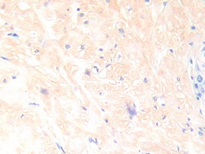 Polyclonal Antibody to Interleukin 13 (IL13)
