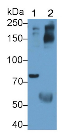 Polyclonal Antibody to Interleukin 1 Receptor Type I (IL1R1)