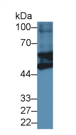 Polyclonal Antibody to Glial Fibrillary Acidic Protein (GFAP)