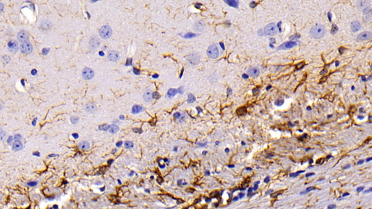 Polyclonal Antibody to Glial Fibrillary Acidic Protein (GFAP)