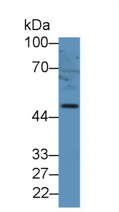 Polyclonal Antibody to Glial Fibrillary Acidic Protein (GFAP)