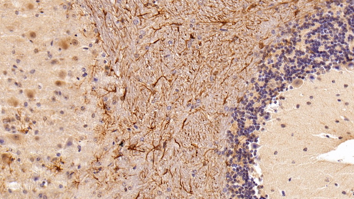 Polyclonal Antibody to Glial Fibrillary Acidic Protein (GFAP)