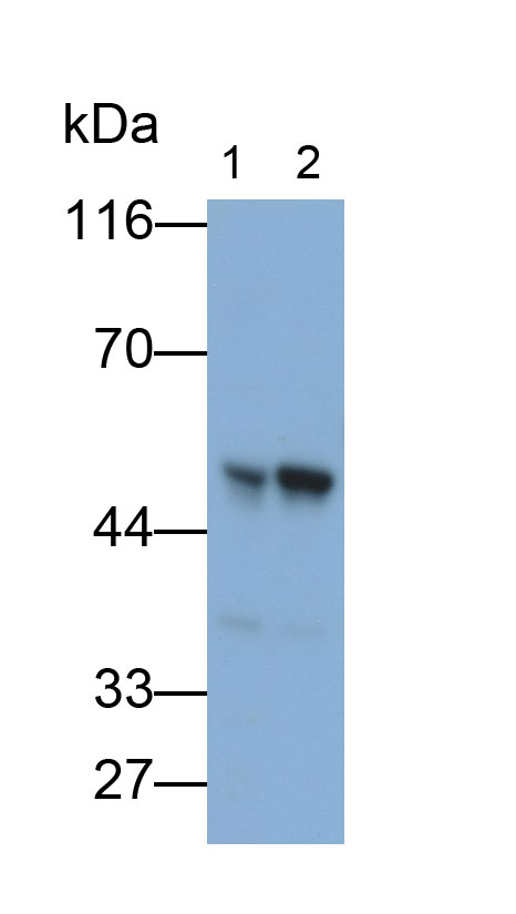 Polyclonal Antibody to Glial Fibrillary Acidic Protein (GFAP)