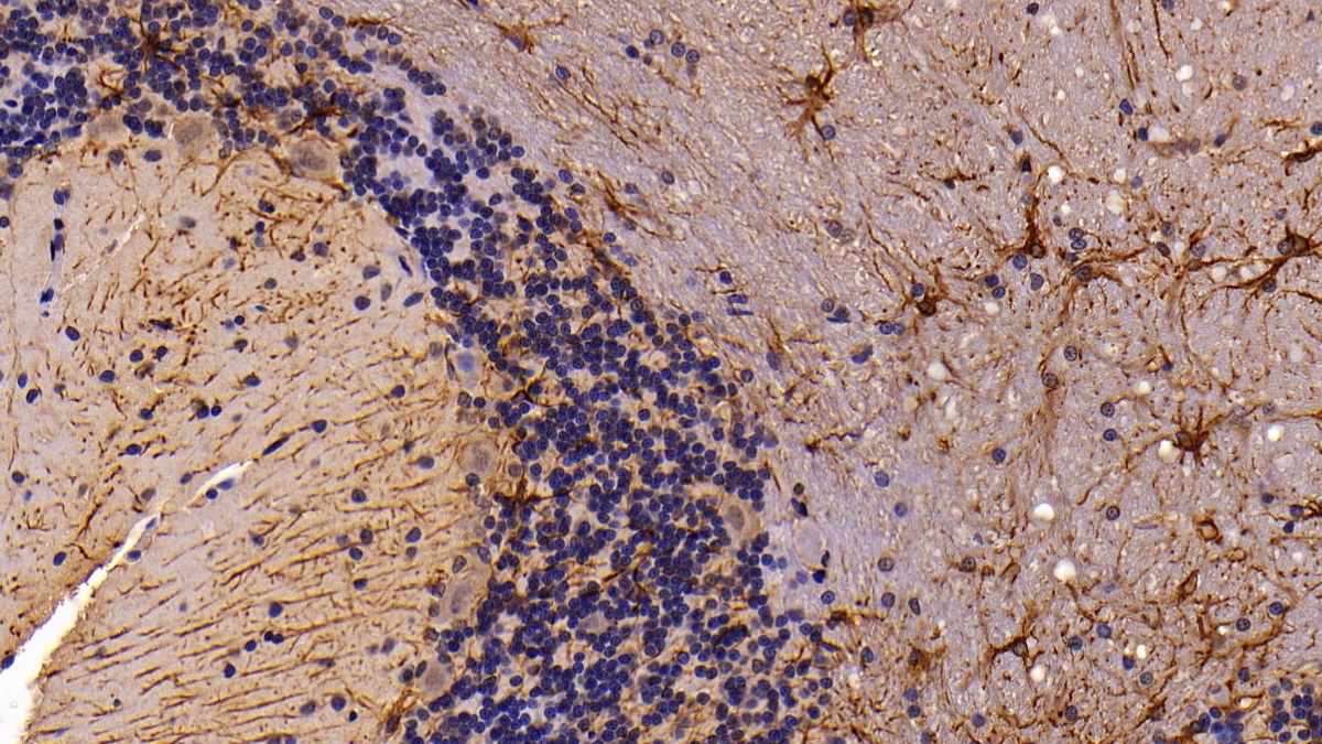 Polyclonal Antibody to Glial Fibrillary Acidic Protein (GFAP)