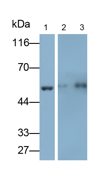 Polyclonal Antibody to Glial Fibrillary Acidic Protein (GFAP)