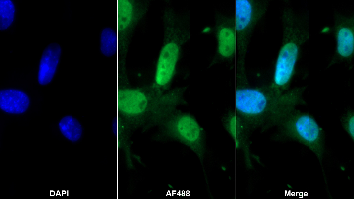 Polyclonal Antibody to Meningioma Expressed Antigen 5 (MGEA5)