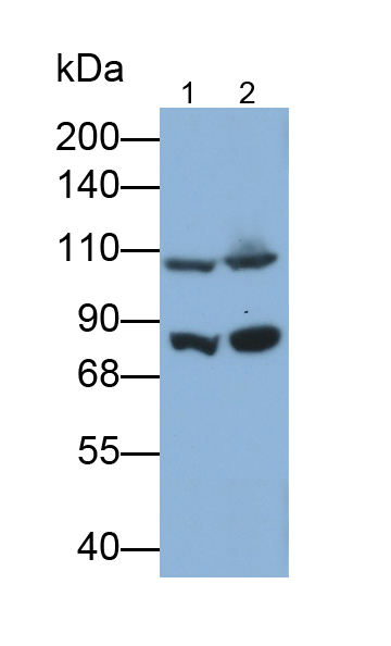Polyclonal Antibody to Meningioma Expressed Antigen 5 (MGEA5)