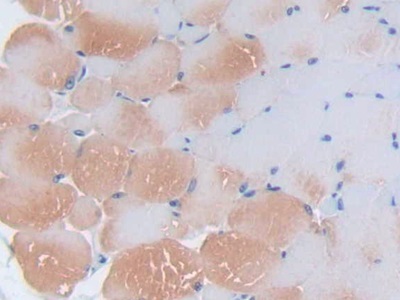 Polyclonal Antibody to Interleukin 2 (IL2)