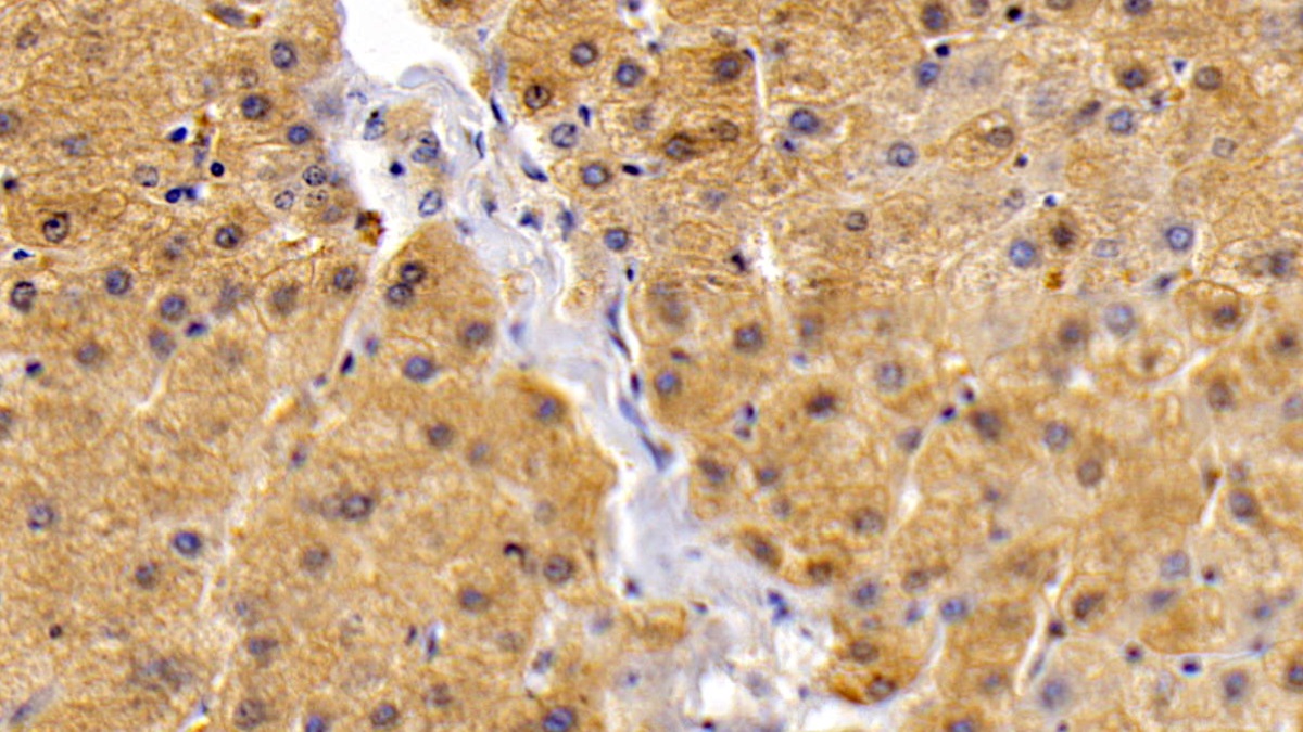 Polyclonal Antibody to Leptin Receptor (LEPR)