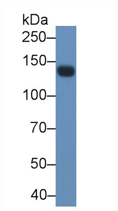 Polyclonal Antibody to Leptin Receptor (LEPR)