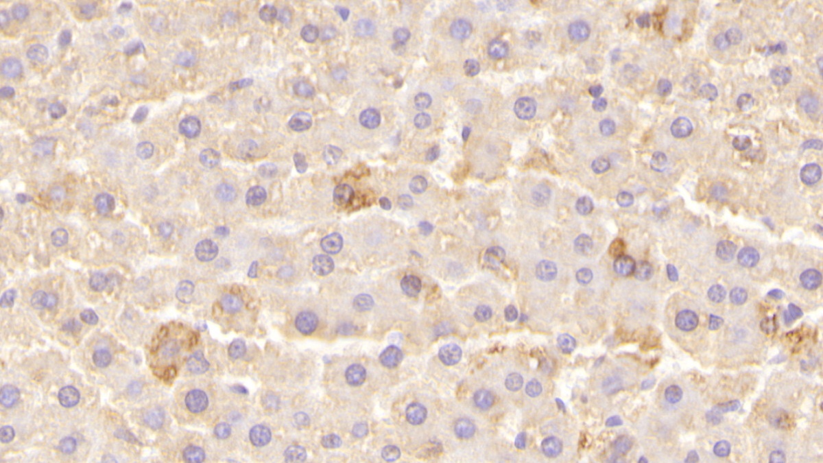 Polyclonal Antibody to Leptin Receptor (LEPR)