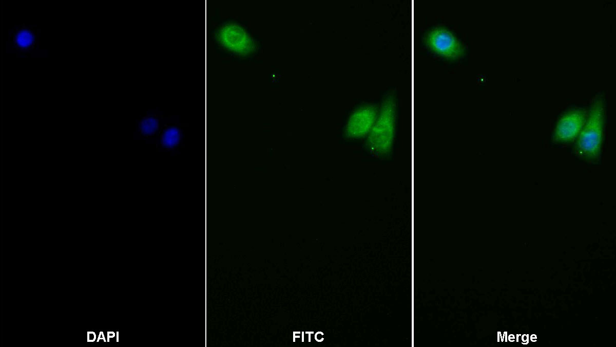 Polyclonal Antibody to Leptin Receptor (LEPR)