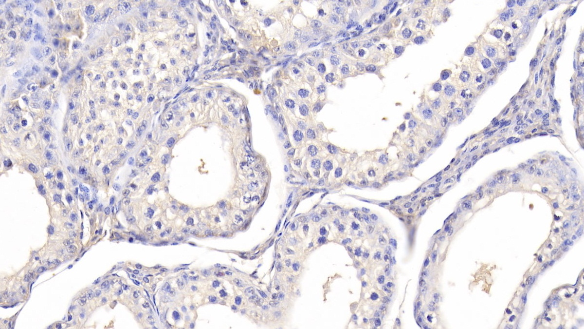 Polyclonal Antibody to Leptin (LEP)