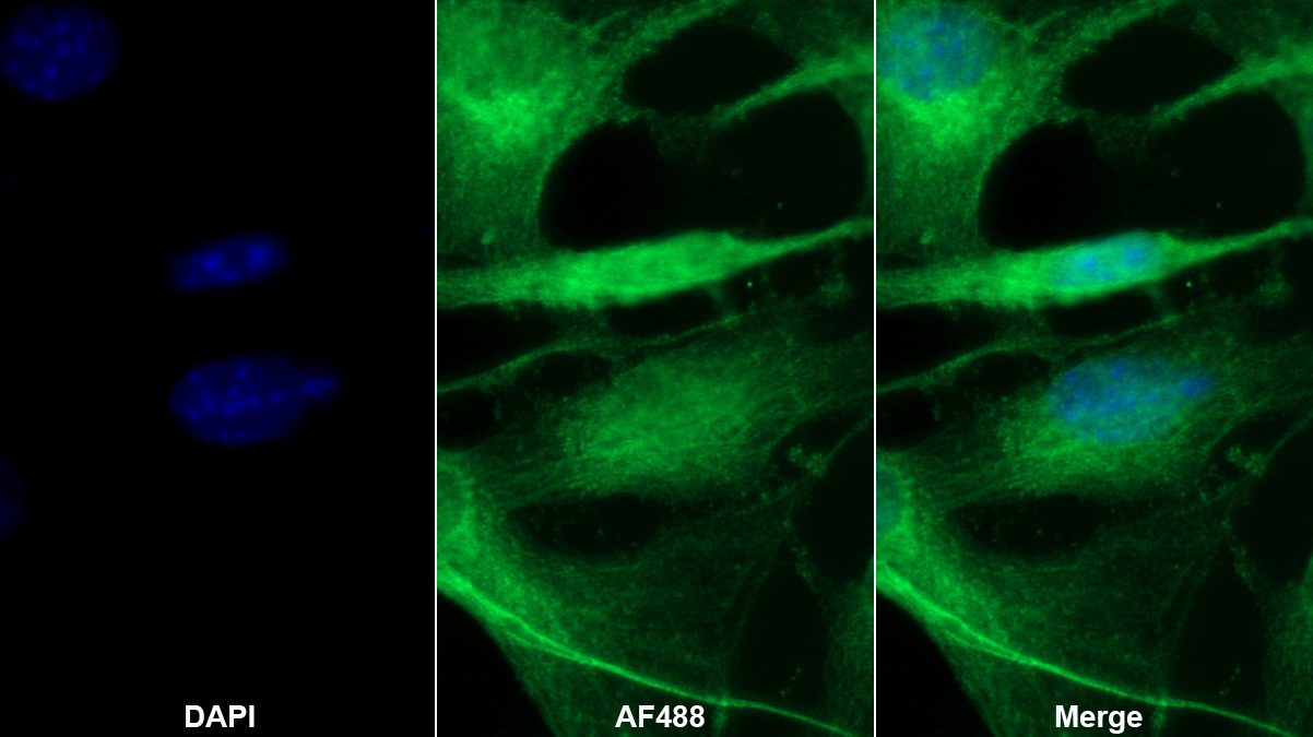 Polyclonal Antibody to Leptin (LEP)