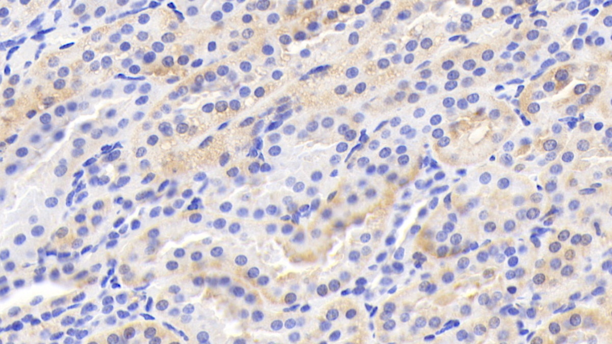 Polyclonal Antibody to Leptin (LEP)