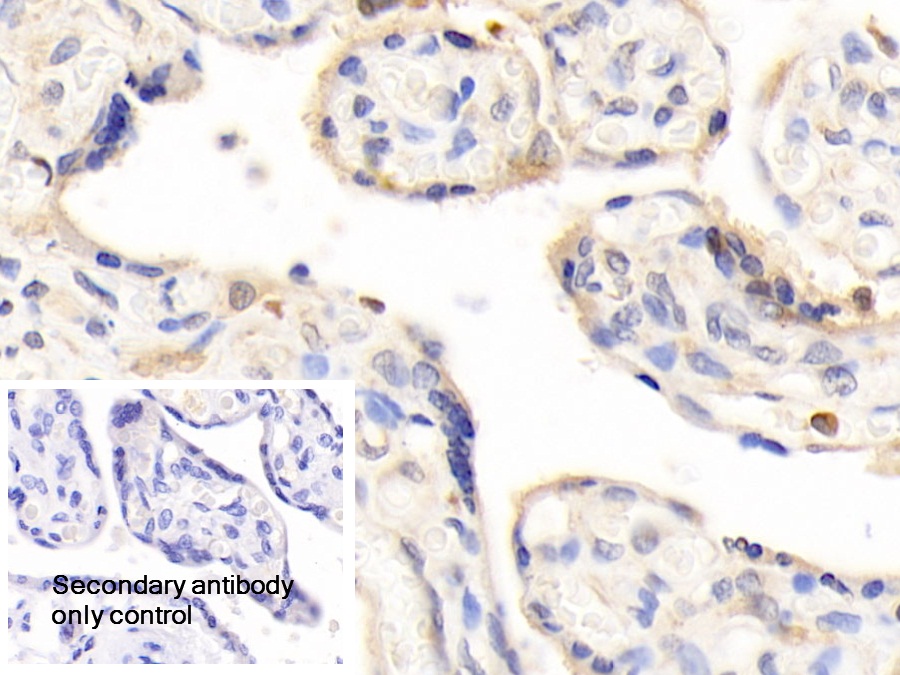 Polyclonal Antibody to Leptin (LEP)