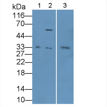 Polyclonal Antibody to Leptin (LEP)