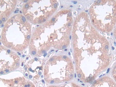 Polyclonal Antibody to Leukemia Inhibitory Factor (LIF)