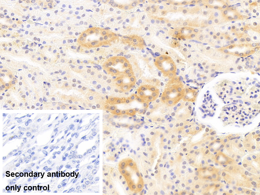 Polyclonal Antibody to Monocyte Chemotactic Protein 1 (MCP1)