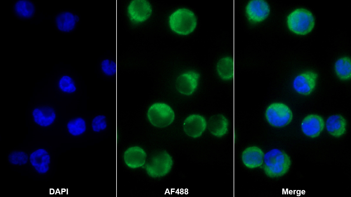 Polyclonal Antibody to Macrophage Inflammatory Protein 3 Beta (MIP3b)