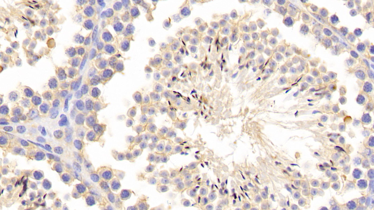 Polyclonal Antibody to Matrix Metalloproteinase 1 (MMP1)