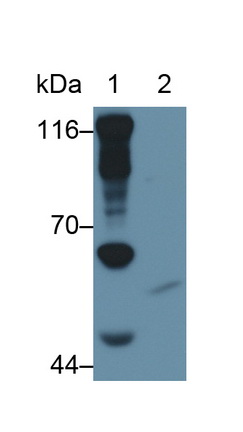 Polyclonal Antibody to Matrix Metalloproteinase 1 (MMP1)