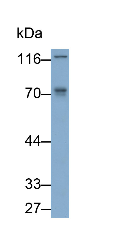 Polyclonal Antibody to Matrix Metalloproteinase 2 (MMP2)