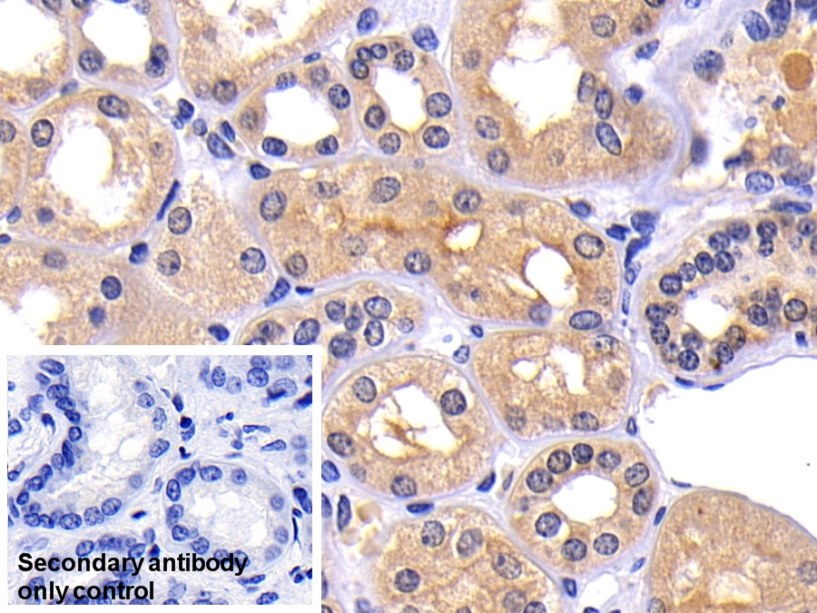 Polyclonal Antibody to Matrix Metalloproteinase 7 (MMP7)