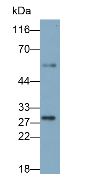 Polyclonal Antibody to Matrix Metalloproteinase 7 (MMP7)