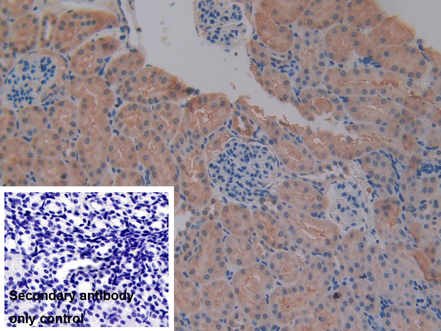Polyclonal Antibody to Matrix Metalloproteinase 7 (MMP7)