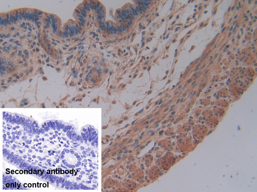 Polyclonal Antibody to Matrix Metalloproteinase 7 (MMP7)