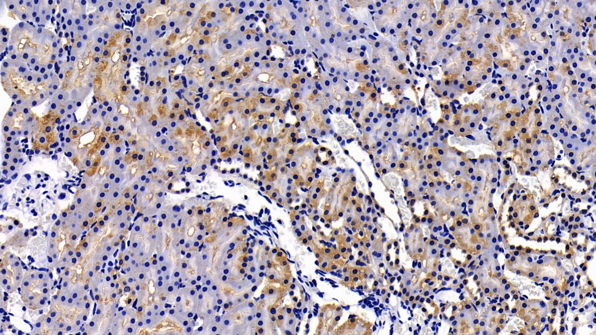 Polyclonal Antibody to Matrix Metalloproteinase 7 (MMP7)