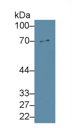 Polyclonal Antibody to Matrix Metalloproteinase 8 (MMP8)