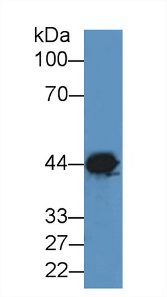 Polyclonal Antibody to Creatine Kinase, Muscle (CKM)