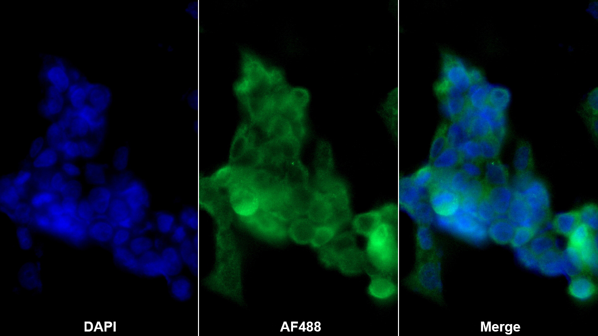 Polyclonal Antibody to Creatine Kinase, Muscle (CKM)