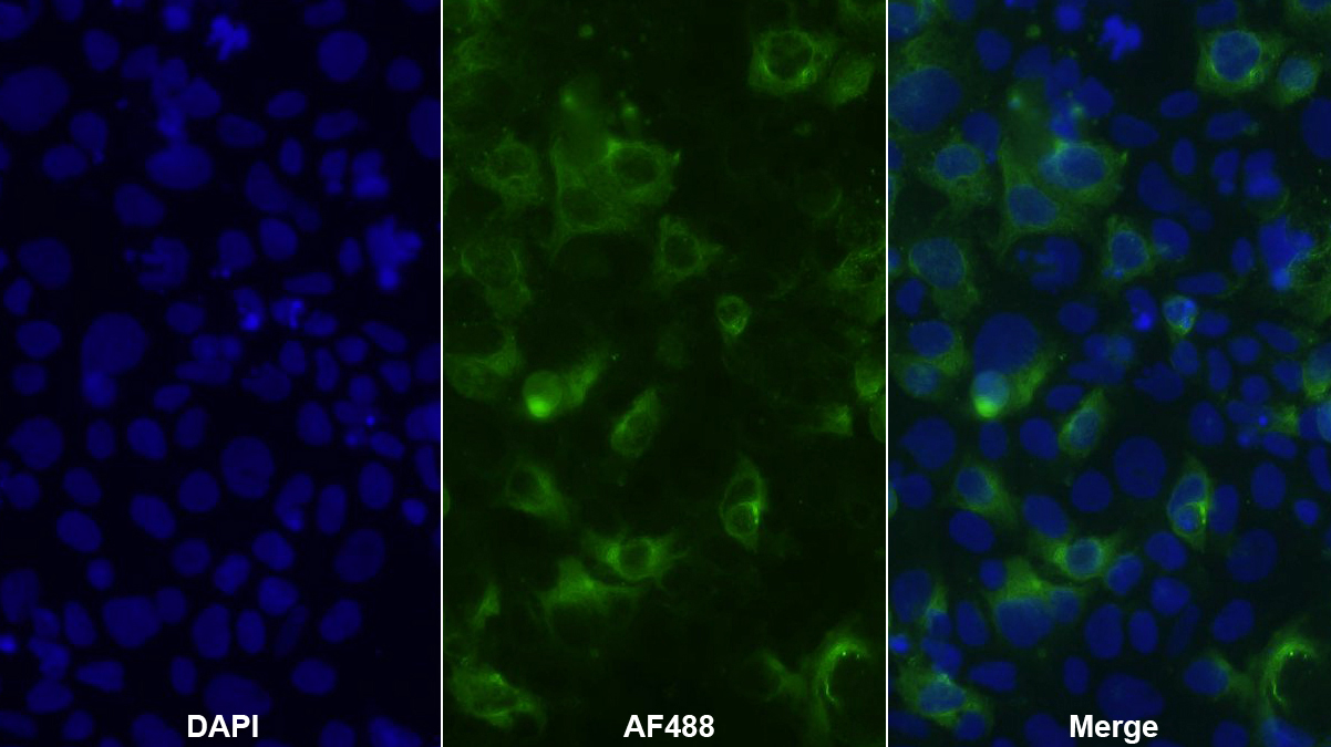 Polyclonal Antibody to Placenta Growth Factor (PLGF)