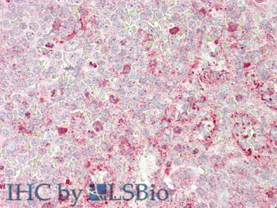 Polyclonal Antibody to Superoxide Dismutase 3, Extracellular (SOD3)