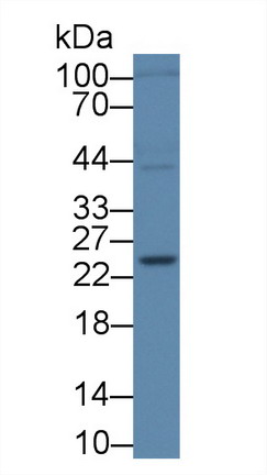 Polyclonal Antibody to Superoxide Dismutase 3, Extracellular (SOD3)