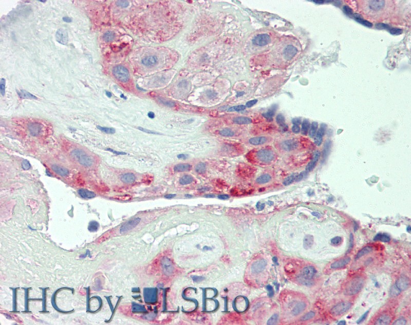 Polyclonal Antibody to Cluster Of Differentiation 30 Ligand (CD30L)