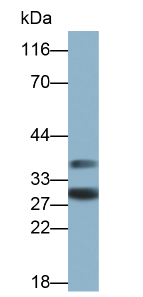 Polyclonal Antibody to Cluster Of Differentiation 30 Ligand (CD30L)