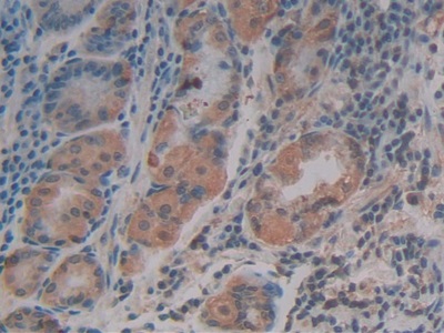 Polyclonal Antibody to Stromal Cell Derived Factor 1 (SDF1)