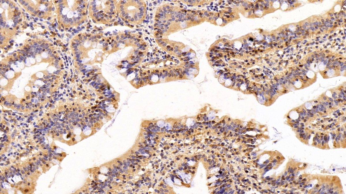Polyclonal Antibody to Transforming Growth Factor Alpha (TGFa)