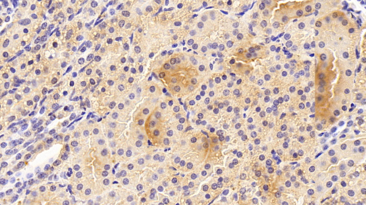 Polyclonal Antibody to Transforming Growth Factor Alpha (TGFa)