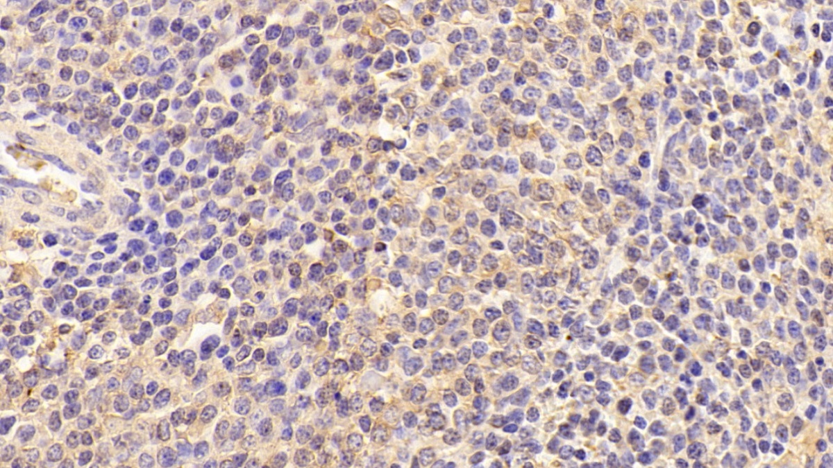 Polyclonal Antibody to Transforming Growth Factor Alpha (TGFa)