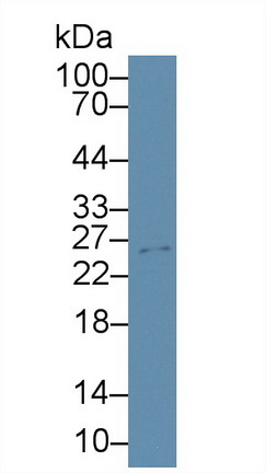 Polyclonal Antibody to Tissue Inhibitors Of Metalloproteinase 4 (TIMP4)